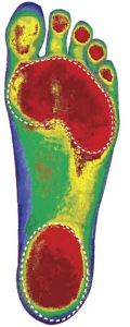 foot-weight-distribution